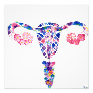 Uterus Foto Afdruk