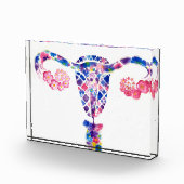 Uterus Fotoblokken (Rechts)