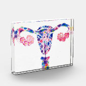 Uterus Fotoblokken (Links)