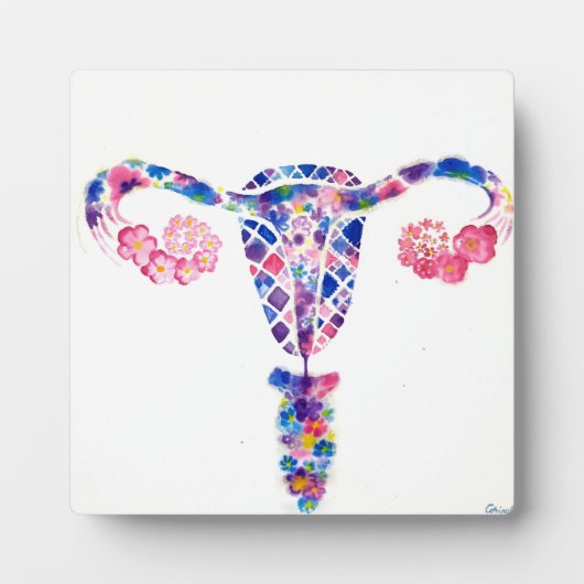 Uterus Fotoplaat (Voorkant)