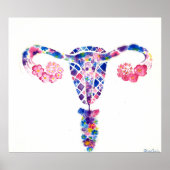 Uterus Poster (Voorkant)