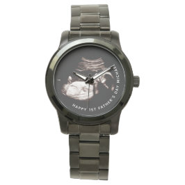 Vaderdag Aangepaste naam Foto Baby Sonogram Watc Horloge