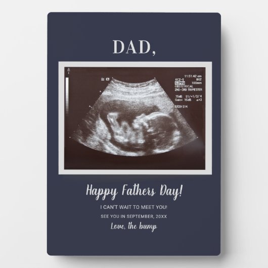 Vaders Day Script Baby echo foto papa Fotoplaat (voorkant)