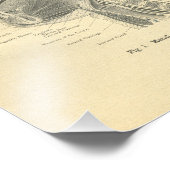  van de anatomische druk foto afdruk (Hoek)