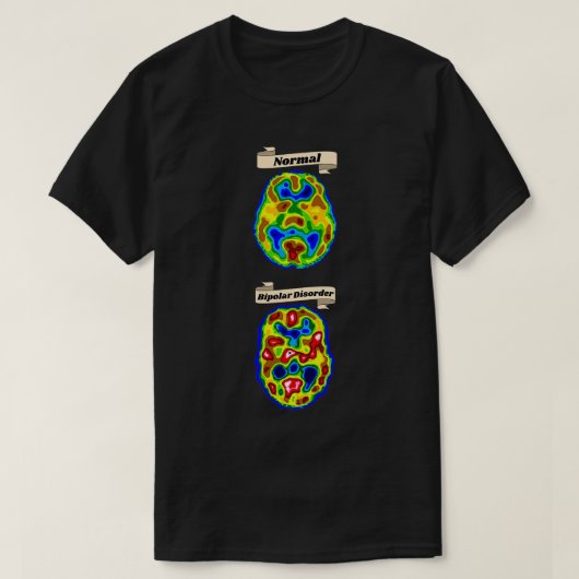 van een normale of bipolaire hersenscan t-shirt (Design voorkant)