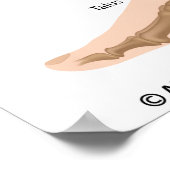 Verankeringsligamenten, gelabelde tekening. poster (Hoek)