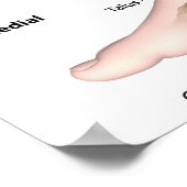 Verankeringsligamenten, gelabelde tekening. poster (Hoek)