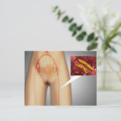 Verkleinde arterie nabij been briefkaart (Staand voorkant)