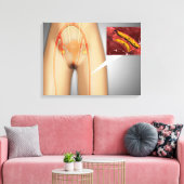 Verkleinde arterie nabij been canvas afdruk (Insitu (Woonkamer))