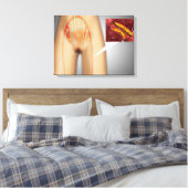 Verkleinde arterie nabij been canvas afdruk (Insitu (Slaapkamer))