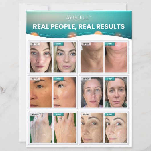 Verkoopblad voor consumenten – echte mensen, echte (Achterkant)