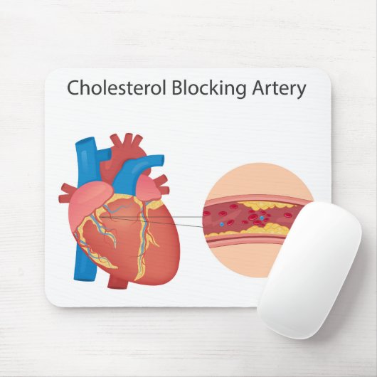 Vernauwde bloedvaten muismat (Met muis)