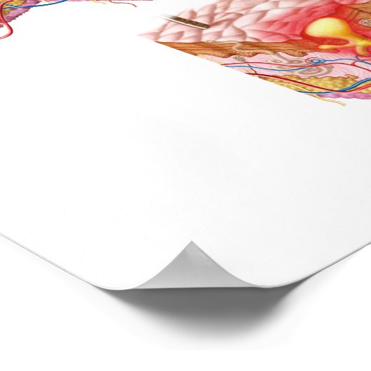 Verschillende soorten Acne Poster (Hoek)