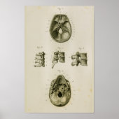 Vertebrae Botten  Anatomie Afdrukken Poster (Voorkant)