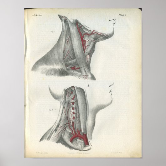 Vertebrale arteriën Hals Anatomie Afdrukken Poster (Voorkant)
