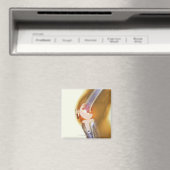 Vervanging knie. Röntgenfoto's, gekleurd, van een  Magneet (Insitu (Vaatwasser))