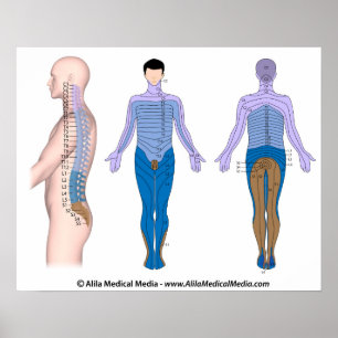 Verwonding van het ruggenmerg, medische tekening. poster