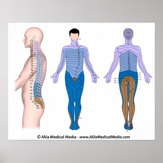 Verwonding van het ruggenmerg, medische tekening. poster (Voorkant)