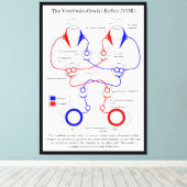 Vestibulo Oculair reflex VOR Oogbeweging stabilise Canvas Afdruk (Insitu (Houten vloer))