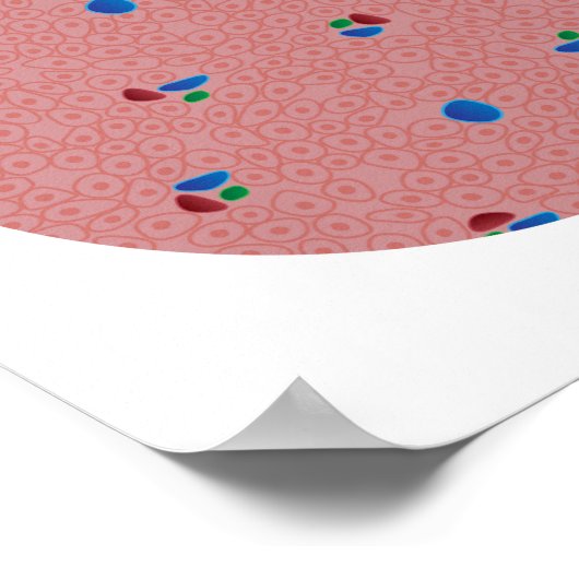 Vetleverziekte Poster (Hoek)