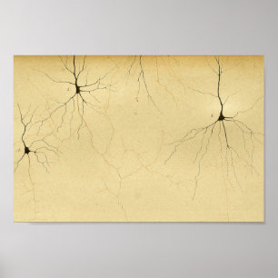 Vintage 1886 Central Nervous System Nerves Poster