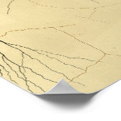 Vintage 1886 Centrale zenuwstelsel Zenuwstelselaan Poster (Hoek)