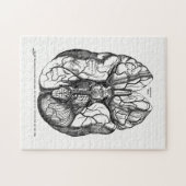 Vintage Anatomy Art Arteries of the Human Brain Legpuzzel (Horizontaal)