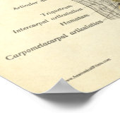 Vintage Anatomy Print Bones Elbow Wrist Joints (Hoek)