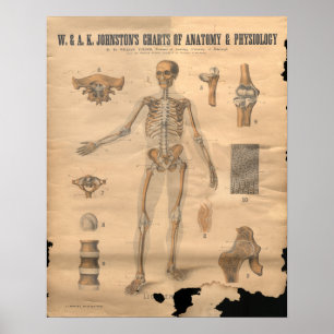 Vintage Skeletspierstelsel- en bindweefselaandoeni Poster