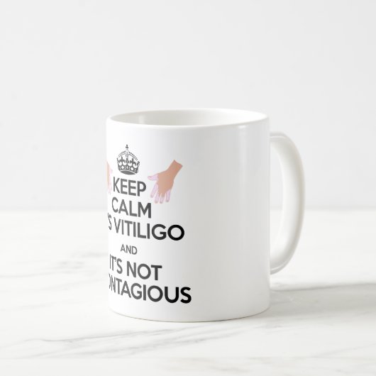 Vitiligo Awareness Day Mok! Koffiemok (Voorkant rechts)