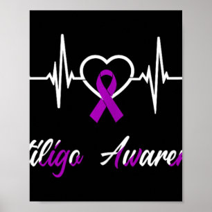 Vitiligo Bewustzijn Hartslag Liefde Paarse Ribbon Poster