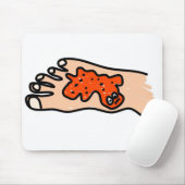 Voetziekte Muismat (Met muis)