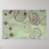 Volvox, algen poster (Voorkant)