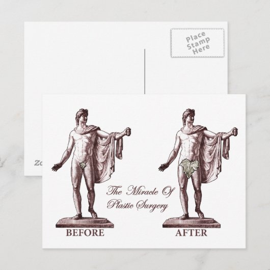 Vóór en na briefkaart (Voorkant / Achterkant)