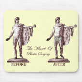 Vóór en na muismat (Voorkant)