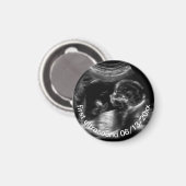 Voor nieuwe moeder: Ultrasound Sonogram Baby Magneet (Voorkant / Achterkant)