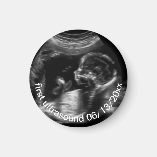 Voor nieuwe moeder: Ultrasound Sonogram Baby Magneet (Voorkant)