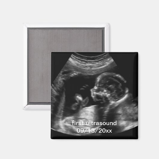 Voor nieuwe moeder: Ultrasound Sonogram Baby Magneet (Voorkant / Achterkant)
