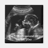 Voor nieuwe moeder: Ultrasound Sonogram Baby Magneet (Voorkant)