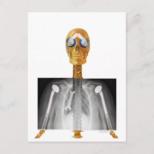 Vooraf gericht Briefkaart op Trump re Trumpcare (Voorkant)