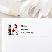 Voorlichting hoofd- en nekkanker 5 etiket (Insitu)