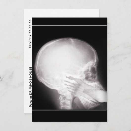 Voorschrift Uitnodigen met voet in mond-röntgenstr Kaart (Voorkant / Achterkant)