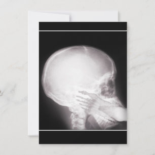 Voorschrift Uitnodigen met voet in mond-röntgenstr Kaart