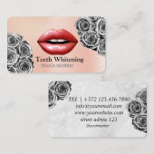 Vrouw Glimlach Tanden Whitening Tandheelkundige Zo Visitekaartje (Voorkant / Achterkant)