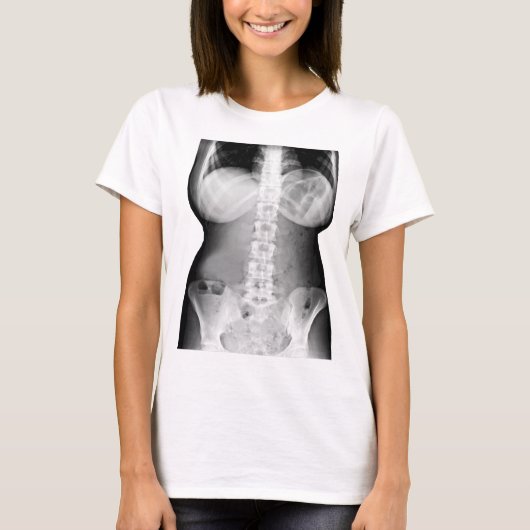 Vrouw Lichaam Röntgenskelet Foto afbeelding T-shirt (Voorkant)