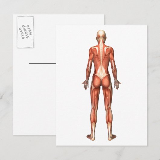 Vrouw spierstelsel- en bindweefselaandoeningen briefkaart (Voorkant / Achterkant)