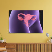 Vrouw, voortplantingsorganen, röntgenfoto-Uitzicht Canvas Afdruk (Insitu (Woonkamer))