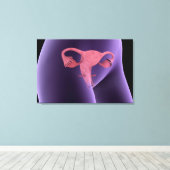 Vrouw, voortplantingsorganen, röntgenfoto-Uitzicht Canvas Afdruk (Insitu (Houten vloer))