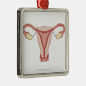 Vrouw Voortplantingsstelsel 2 Metalen Ornament (Rechts)