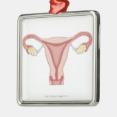 Vrouw Voortplantingsstelsel 2 Metalen Ornament (Links)